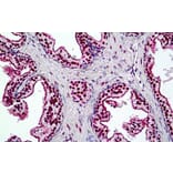 Immunohistochemistry - Anti-BRG1 Antibody (A326223) - Antibodies.com