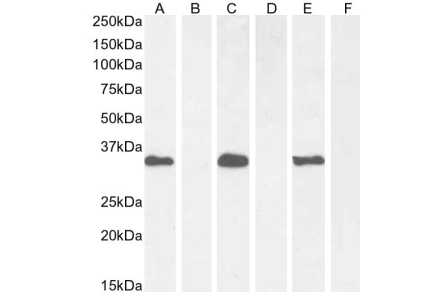 Western Blot - Anti-BRN3B/POU4F2 Antibody (A326224) - Antibodies.com