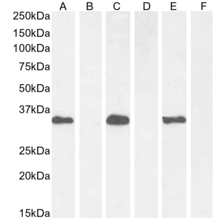 Western Blot - Anti-BRN3B/POU4F2 Antibody (A326224) - Antibodies.com