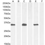 Western Blot - Anti-BRN3B/POU4F2 Antibody (A326224) - Antibodies.com