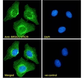 Immunofluorescence - Anti-BRSK2 Antibody (A326225) - Antibodies.com