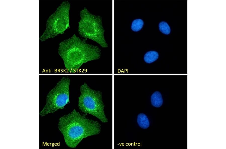 Immunofluorescence - Anti-BRSK2 Antibody (A326225) - Antibodies.com