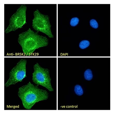 Immunofluorescence - Anti-BRSK2 Antibody (A326225) - Antibodies.com