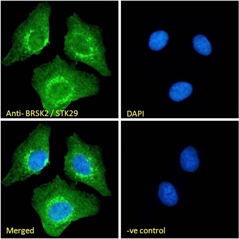 Immunofluorescence - Anti-BRSK2 Antibody (A326225) - Antibodies.com