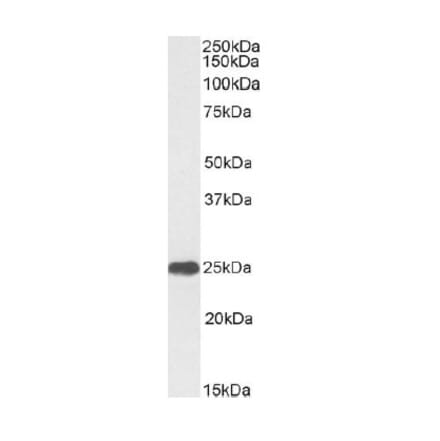 Western Blot - Anti-C Reactive Protein Antibody (A326226) - Antibodies.com