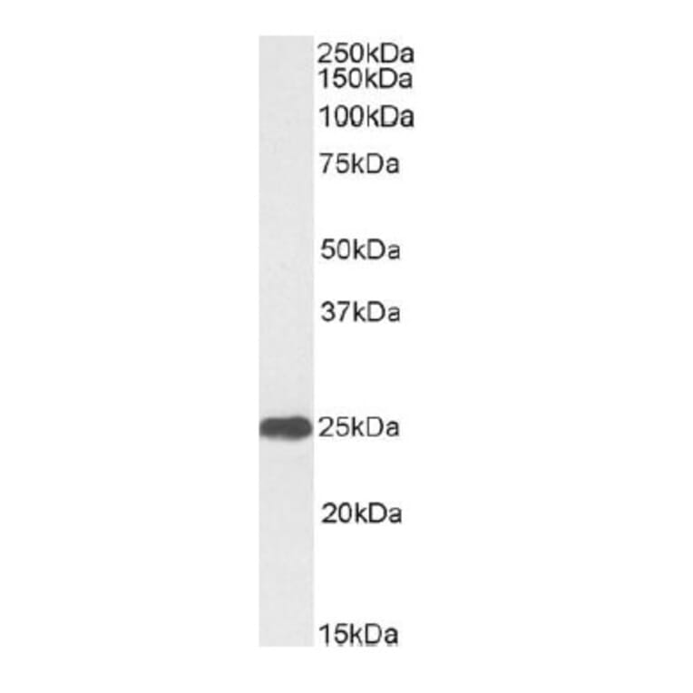 Western Blot - Anti-C Reactive Protein Antibody (A326226) - Antibodies.com