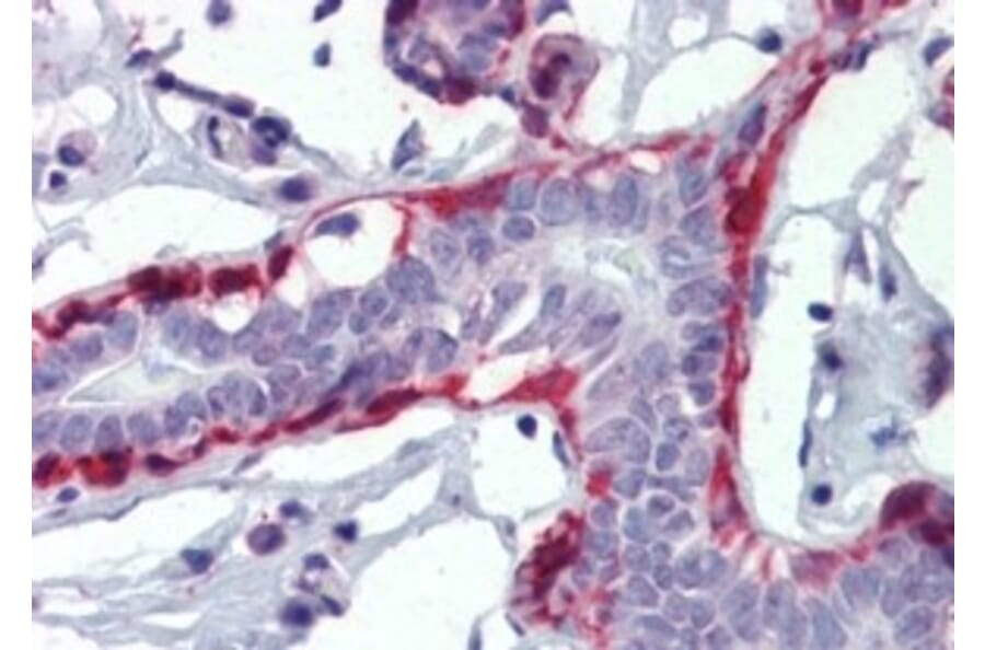 Immunohistochemistry - Anti-Calponin 1 Antibody (A326228) - Antibodies.com
