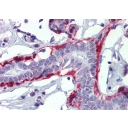 Immunohistochemistry - Anti-Calponin 1 Antibody (A326228) - Antibodies.com