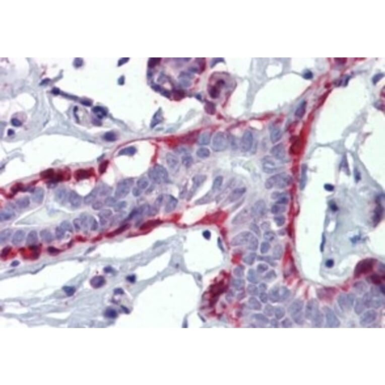 Immunohistochemistry - Anti-Calponin 1 Antibody (A326228) - Antibodies.com