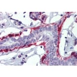 Immunohistochemistry - Anti-Calponin 1 Antibody (A326228) - Antibodies.com