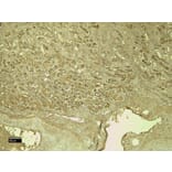 Immunohistochemistry - Anti-CD31 Antibody (A326230) - Antibodies.com