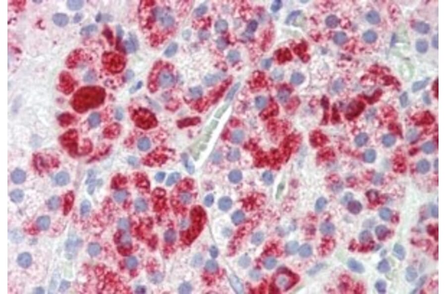 Immunohistochemistry - Anti-Clathrin Heavy Chain Antibody (A326232) - Antibodies.com