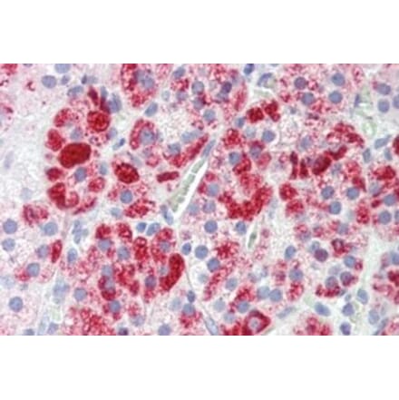 Immunohistochemistry - Anti-Clathrin Heavy Chain Antibody (A326232) - Antibodies.com