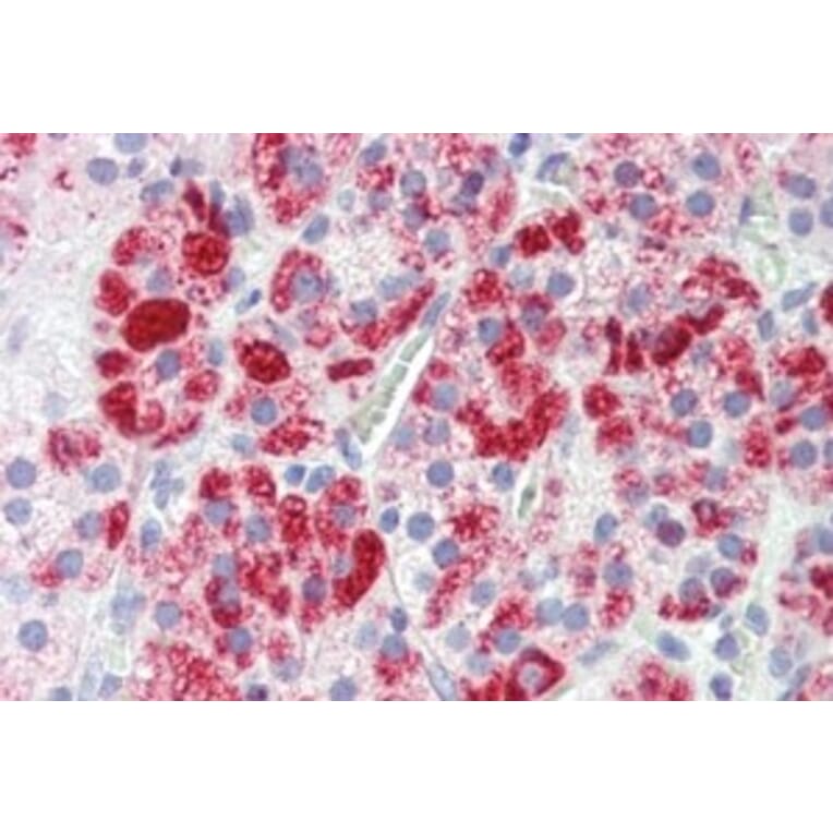 Immunohistochemistry - Anti-Clathrin Heavy Chain Antibody (A326232) - Antibodies.com