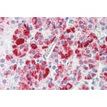 Immunohistochemistry - Anti-Clathrin Heavy Chain Antibody (A326232) - Antibodies.com