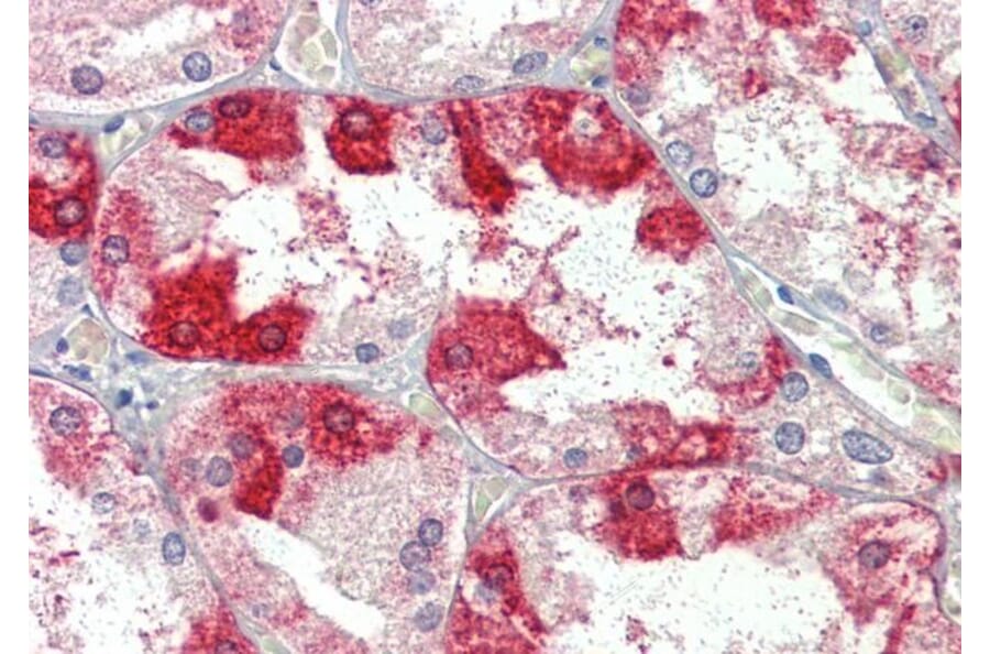 Immunohistochemistry - Anti-Clathrin Heavy Chain Antibody (A326232) - Antibodies.com
