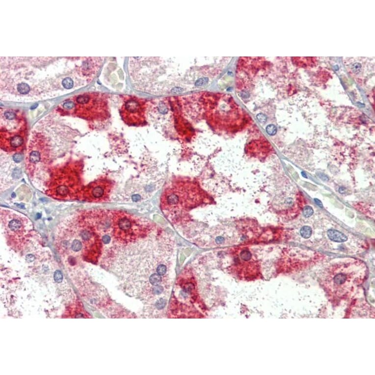 Immunohistochemistry - Anti-Clathrin Heavy Chain Antibody (A326232) - Antibodies.com