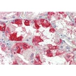 Immunohistochemistry - Anti-Clathrin Heavy Chain Antibody (A326232) - Antibodies.com