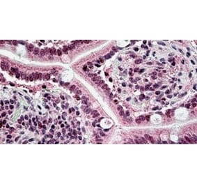 Immunohistochemistry - Anti-CSB/ERCC6 Antibody (A326236) - Antibodies.com