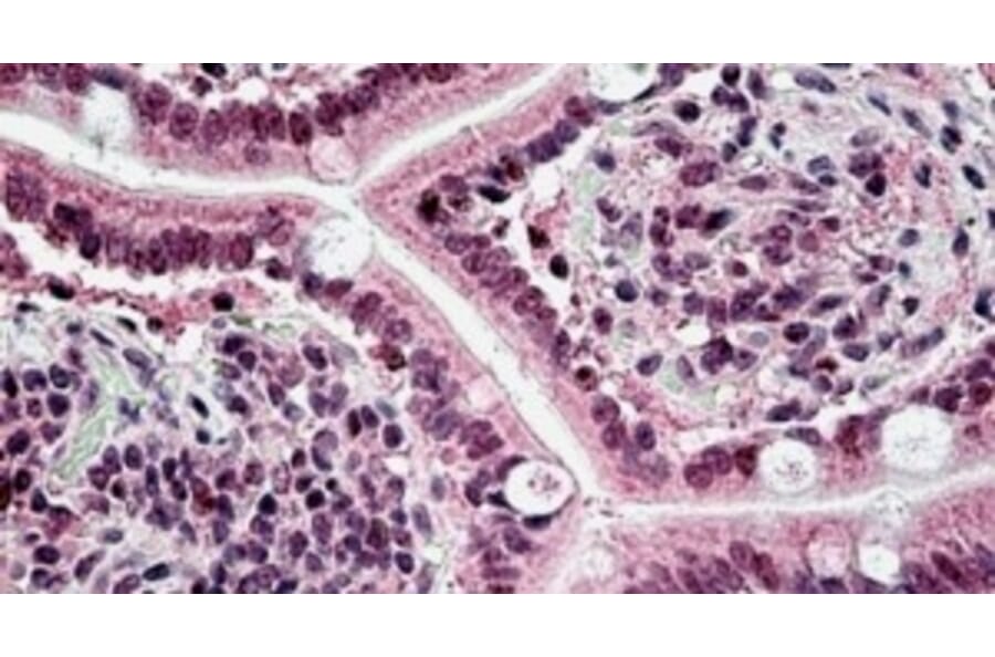 Immunohistochemistry - Anti-CSB/ERCC6 Antibody (A326236) - Antibodies.com