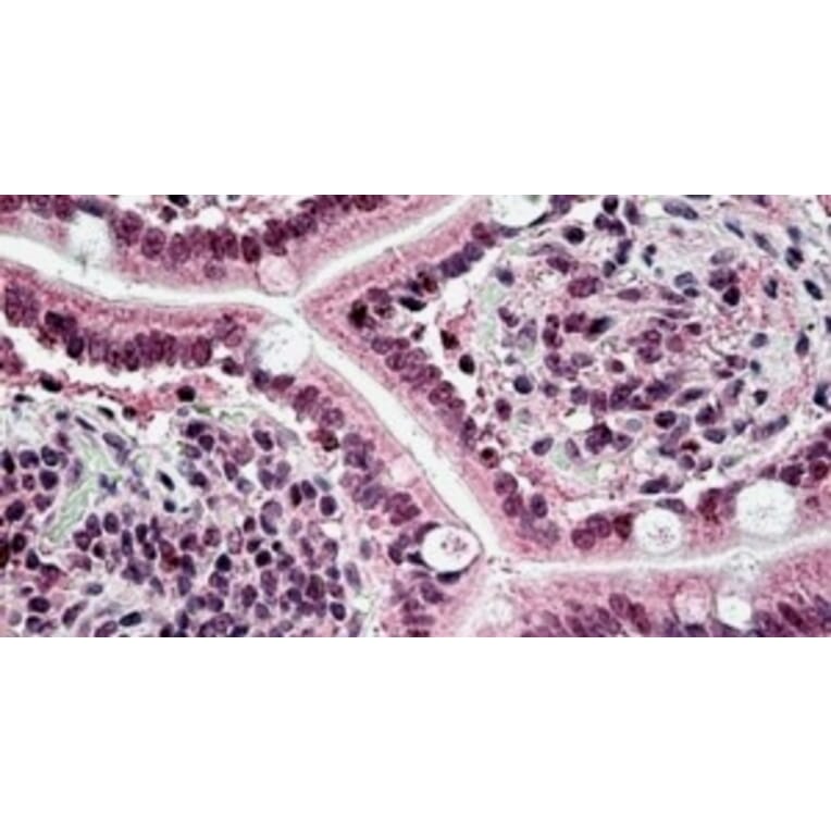 Immunohistochemistry - Anti-CSB/ERCC6 Antibody (A326236) - Antibodies.com