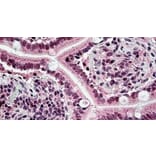 Immunohistochemistry - Anti-CSB/ERCC6 Antibody (A326236) - Antibodies.com