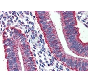 Immunohistochemistry - Anti-DAP12 Antibody (A326238) - Antibodies.com