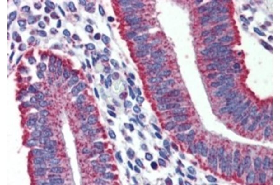Immunohistochemistry - Anti-DAP12 Antibody (A326238) - Antibodies.com