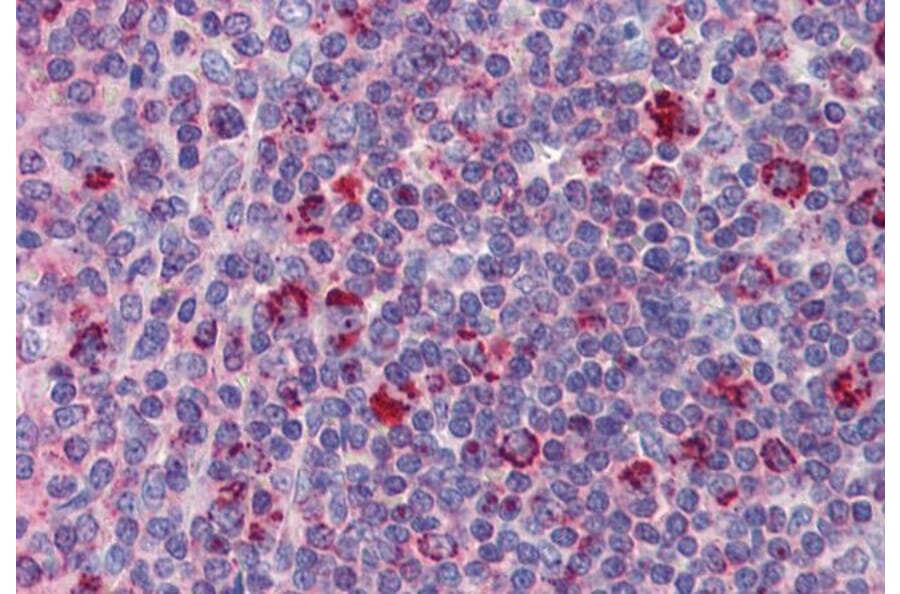 Immunohistochemistry - Anti-DAP12 Antibody (A326238) - Antibodies.com