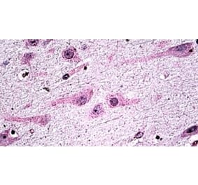 Immunohistochemistry - Anti-Dicer Antibody (A326239) - Antibodies.com