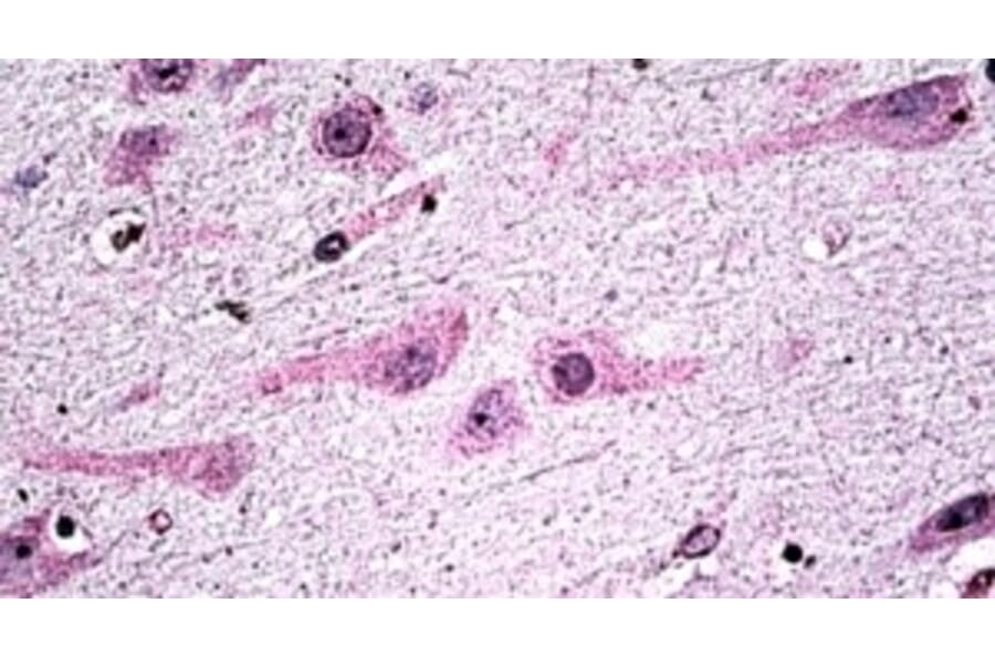Immunohistochemistry - Anti-Dicer Antibody (A326239) - Antibodies.com