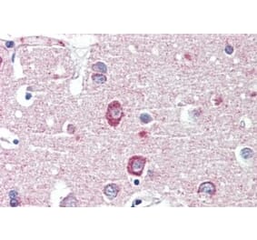 Immunohistochemistry - Anti-DLGAP1 Antibody (A326240) - Antibodies.com