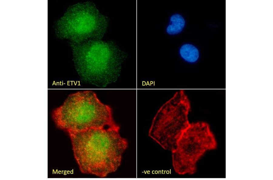 Immunofluorescence - Anti-ER81/ETV1 Antibody (A326241) - Antibodies.com