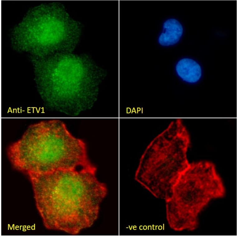 Immunofluorescence - Anti-ER81/ETV1 Antibody (A326241) - Antibodies.com