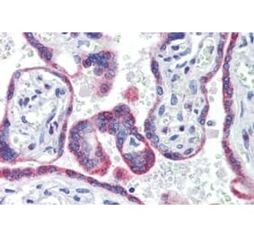 Immunohistochemistry - Anti-Estrogen Receptor beta Antibody (A326242) - Antibodies.com