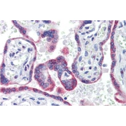 Immunohistochemistry - Anti-Estrogen Receptor beta Antibody (A326242) - Antibodies.com