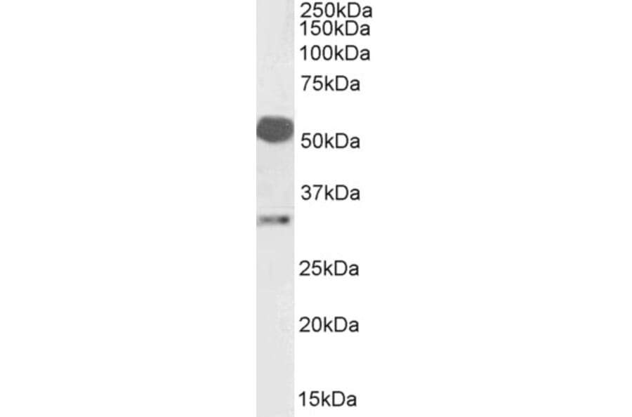Western Blot - Anti-Estrogen Receptor beta Antibody (A326242) - Antibodies.com