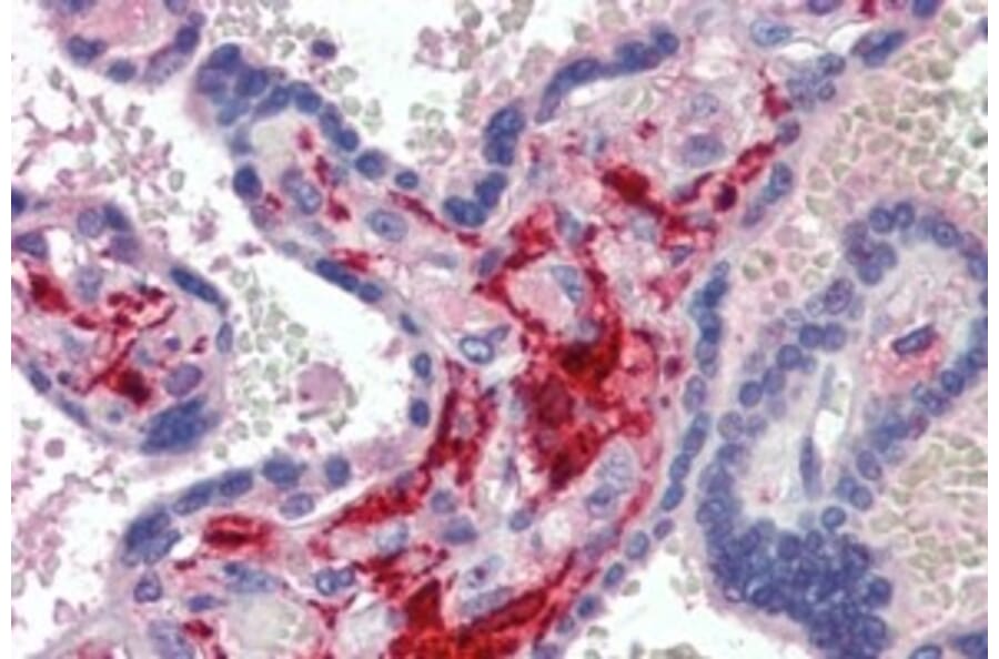 Immunohistochemistry - Anti-Factor XIIIa Antibody (A326244) - Antibodies.com