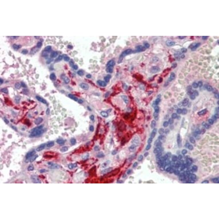 Immunohistochemistry - Anti-Factor XIIIa Antibody (A326244) - Antibodies.com