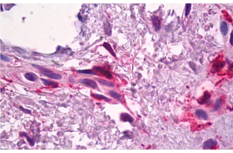 Immunohistochemistry - Anti-Factor XIIIa Antibody (A326244) - Antibodies.com