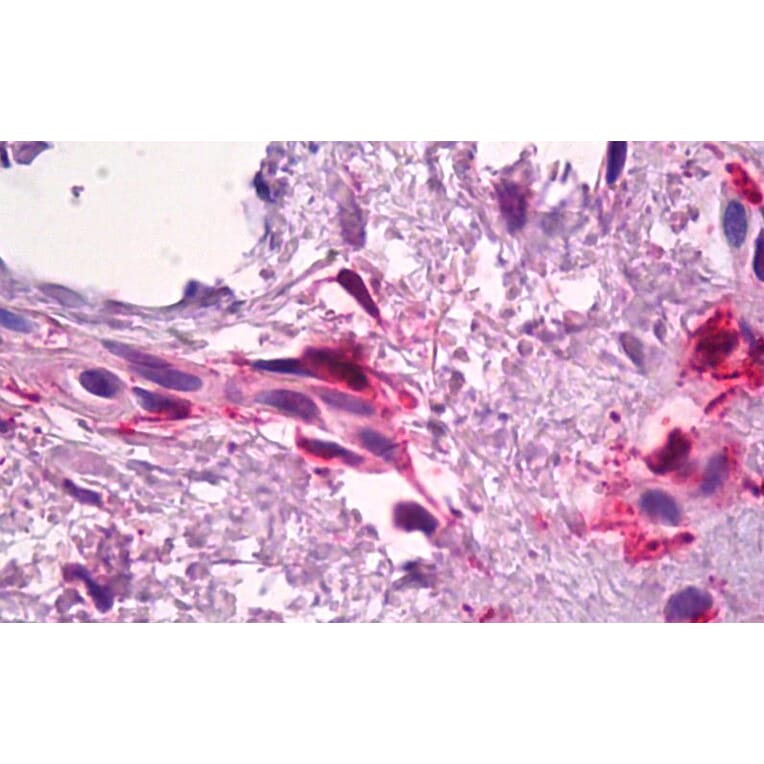 Immunohistochemistry - Anti-Factor XIIIa Antibody (A326244) - Antibodies.com
