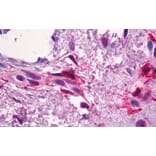 Immunohistochemistry - Anti-Factor XIIIa Antibody (A326244) - Antibodies.com