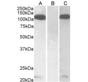 Western Blot - Anti-Furin Antibody (A326245) - Antibodies.com