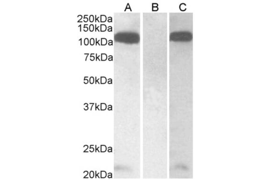Western Blot - Anti-Furin Antibody (A326245) - Antibodies.com