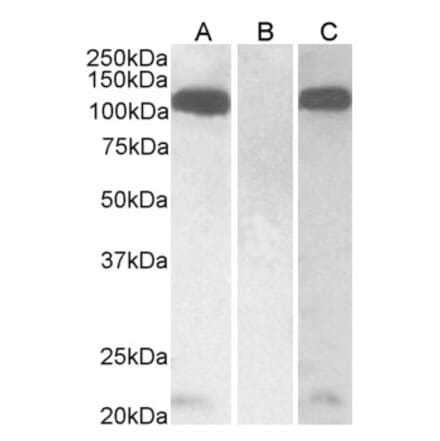 Western Blot - Anti-Furin Antibody (A326245) - Antibodies.com