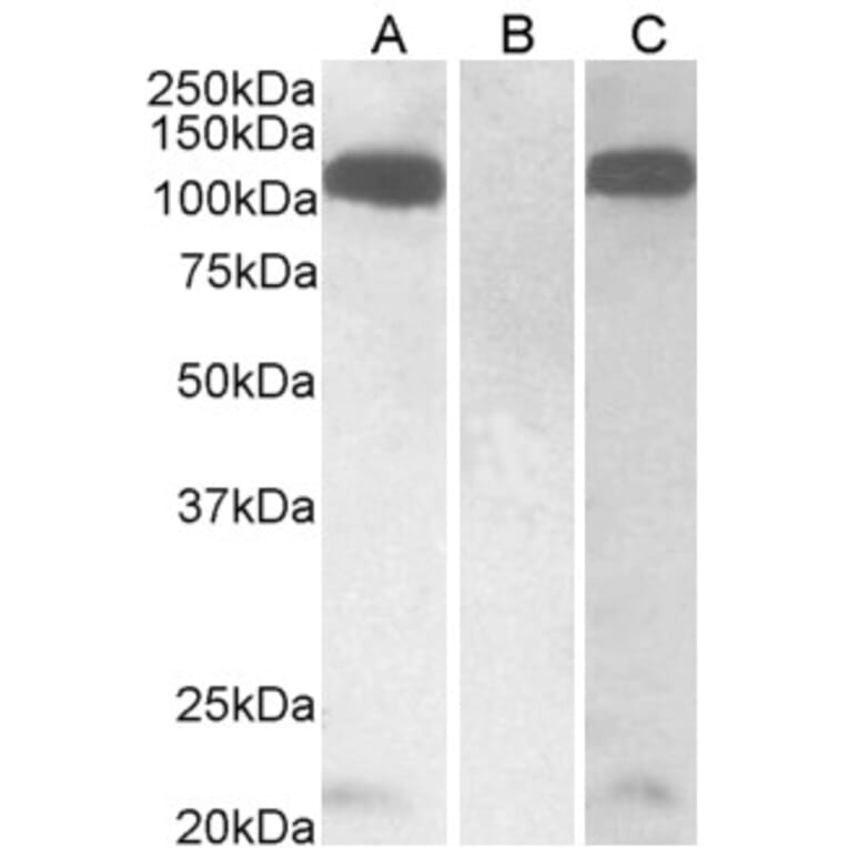 Western Blot - Anti-Furin Antibody (A326245) - Antibodies.com