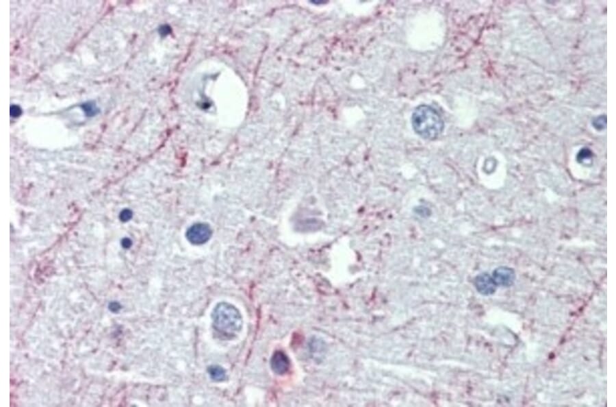 Immunohistochemistry - Anti-GABA B Receptor 1 Antibody (A326247) - Antibodies.com