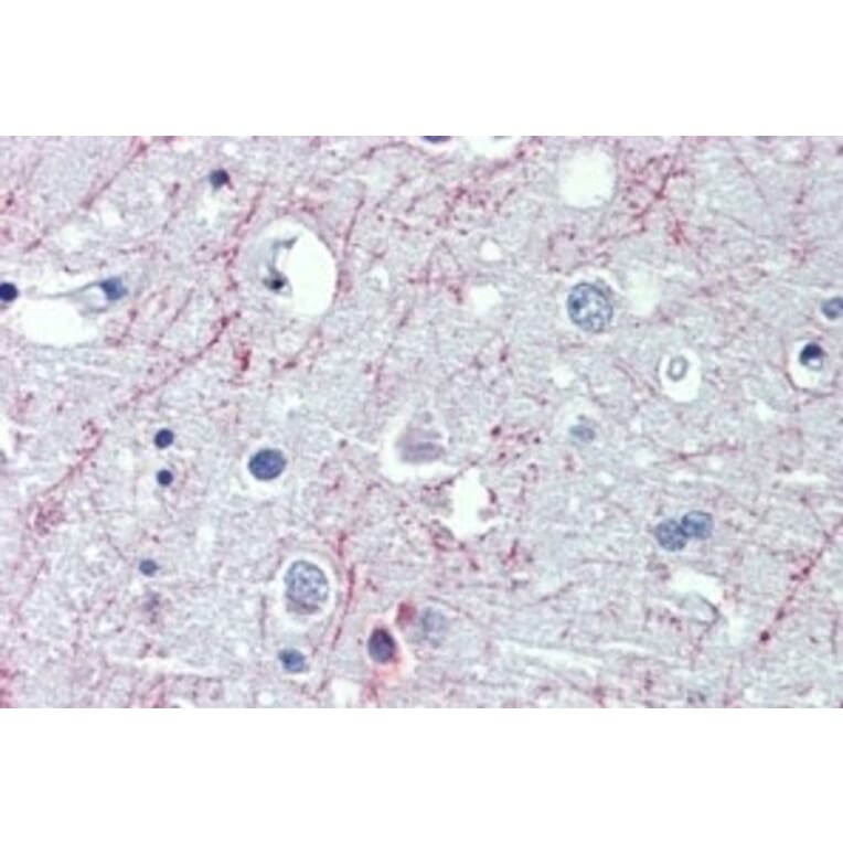 Immunohistochemistry - Anti-GABA B Receptor 1 Antibody (A326247) - Antibodies.com