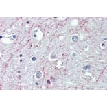 Immunohistochemistry - Anti-GABA B Receptor 1 Antibody (A326247) - Antibodies.com