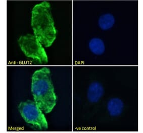 Immunofluorescence - Anti-Glucose Transporter GLUT2 Antibody (A326249) - Antibodies.com